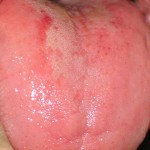 tongue_b